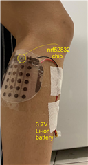 Annotated picture of the sEMG device placed on my leg